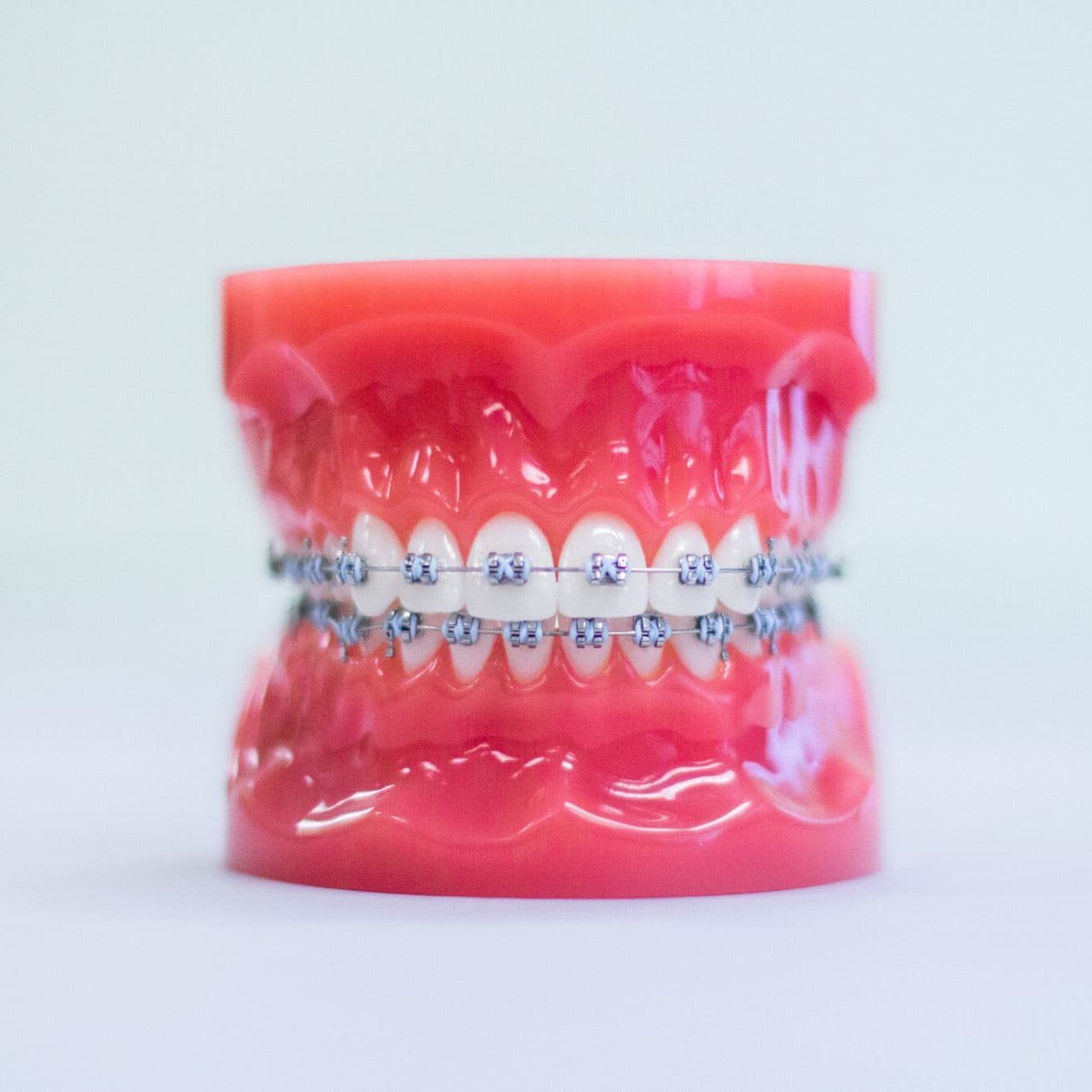 Braces vs. Invisalign: Choosing the Right Treatment